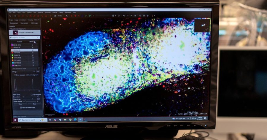 researchers-try-bold-new-approach-in-race-to-treat-autoimmune-diseases