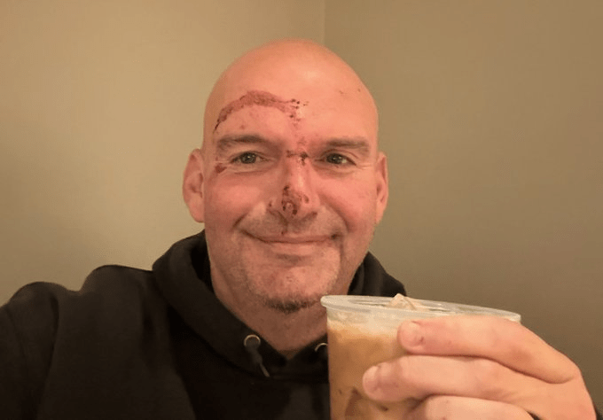 senator-john-fetterman-receives-20-stitches-after-fall