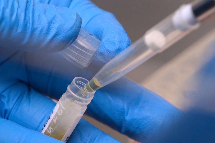 nih-funding-cuts-have-affected-over-74,000-people-enrolled-in-experiments,-a-new-report-says