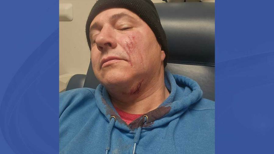 local-animal-rescuer-suffers-severe-bite-at-shelter