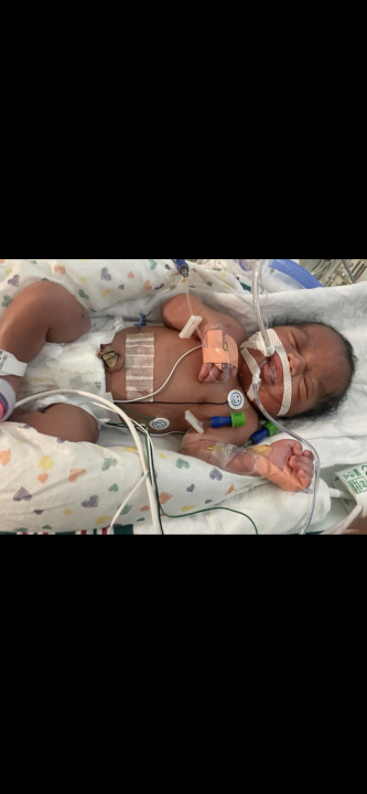 ‘she-was-a-miracle-baby’:-family-of-florida-newborn-shot-in-the-womb-speaks