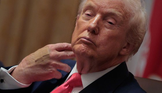 trump’s-bandaged-hand-caught-on-camera-again