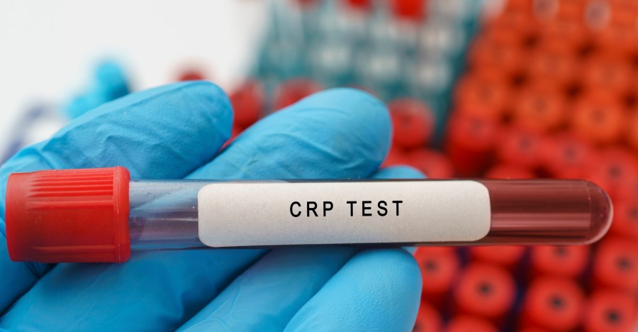 c-reactive protein-outranks-‘bad’-cholesterol-as-leading-heart-disease-risk marker