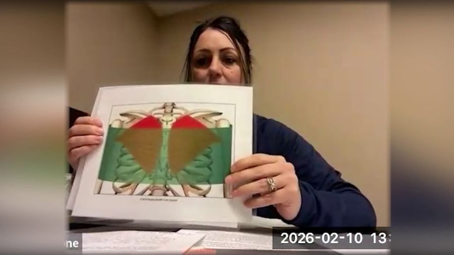 mercy-health-starts-new-heart-surgery-recovery-plan