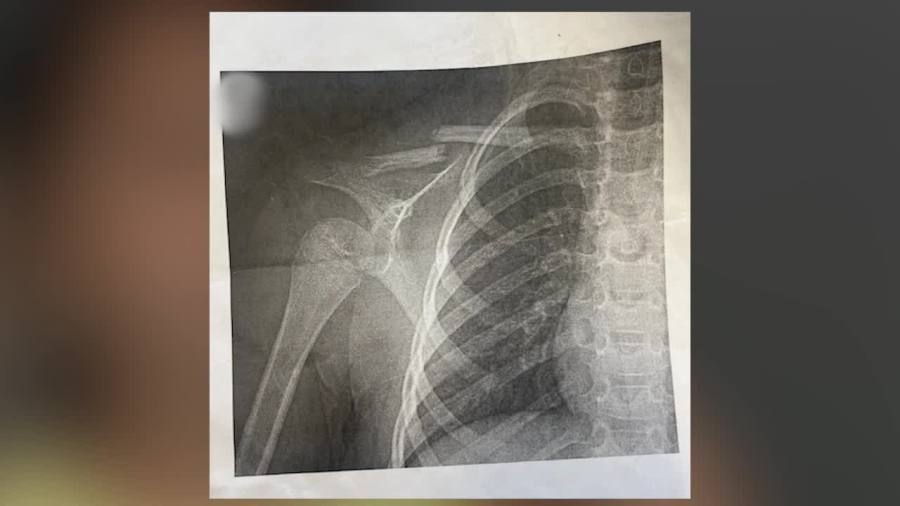 former-daycare-worker-indicted-after-child-injured:-i-team