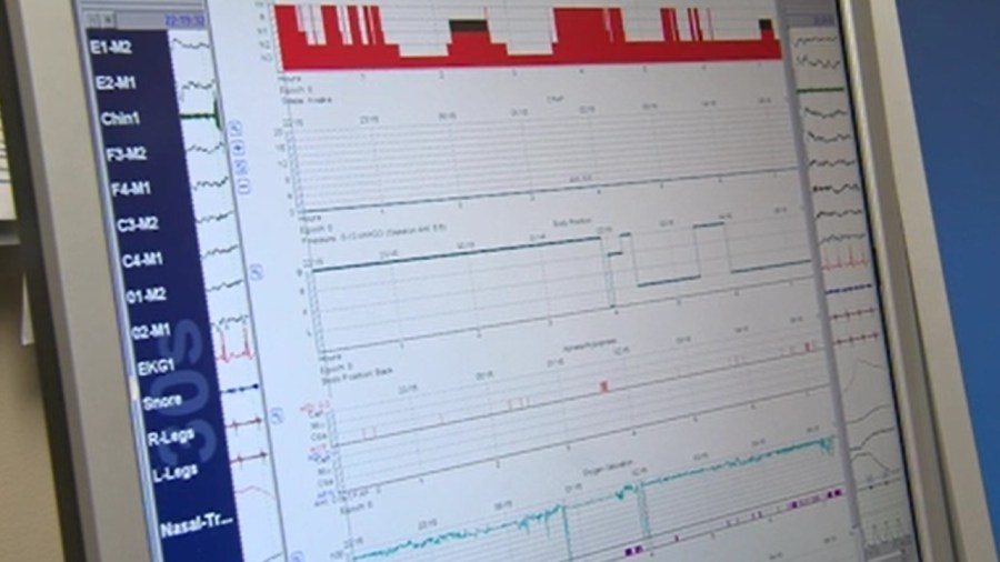 do-sleep-trackers-actually-work?