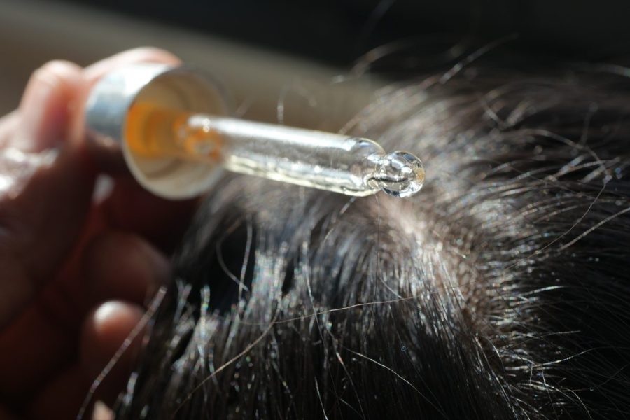 hair-growth-products-sold-on-amazon-are-recalled-over-poisoning-risk