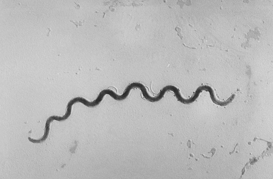syphilis-making-a-comeback,-health-officials-warn.-cdc-map-shows-where-risk-is-highest
