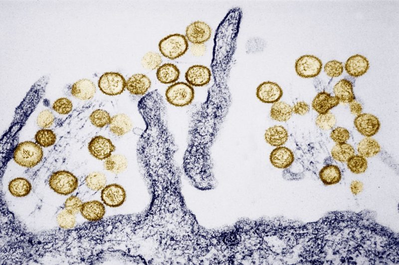 what-causes-hantavirus-in-the-us?
