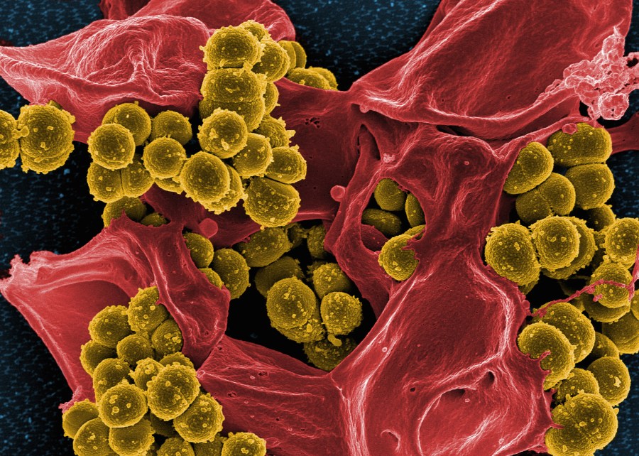 eczema-cream-recalled-over-risk-of-‘life-threatening’-staph-infection