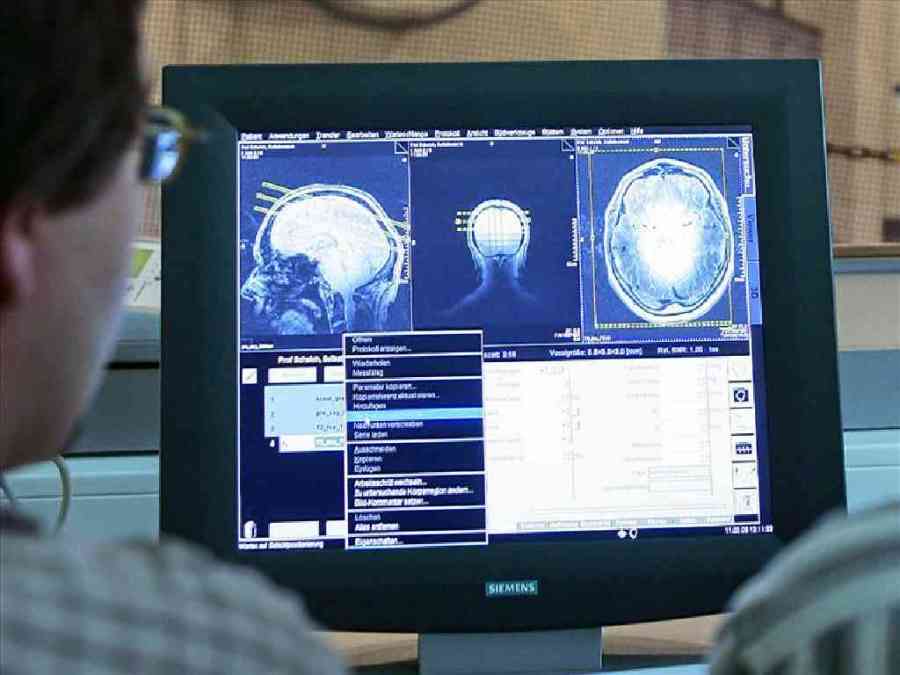 blood-biomarkers-could-detect-earliest-signs-of-alzheimer’s-disease-–-and-slow-its progression