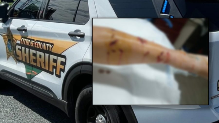 woman-severely-injured-after-alligator-latches-onto-leg-at-florida-park