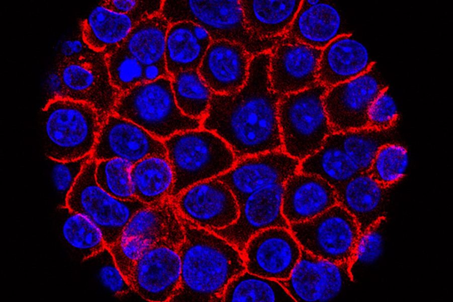 experimental-pill-promises-new-hope-for-deadly-pancreatic-cancer