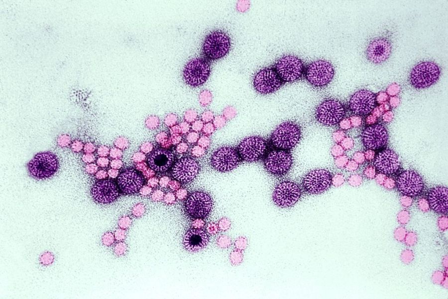 presence-of-rare-infection-that-can-be-severe-in-kids-declines,-except-in-one-region