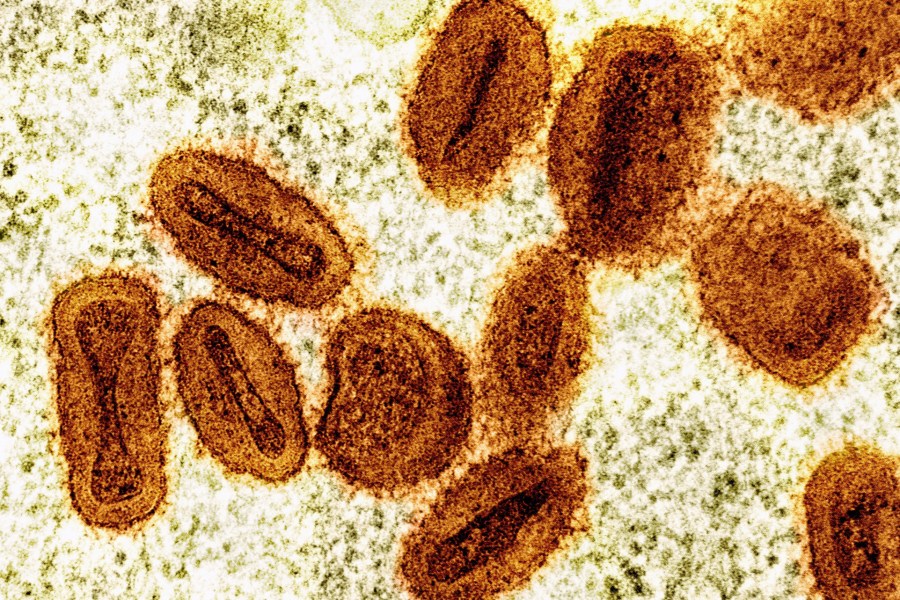 2-scientists-charged-with-bringing-deactivated-mpox-virus-into-the-us-and-lying-to-authorities