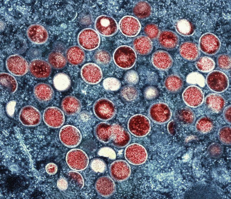 nih-researchers-charged-with-trying-to-smuggle-monkeypox-into-us:-doj