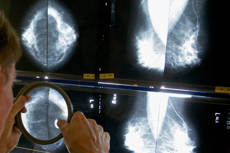 breast-cancer-outbreak-at-massachusetts-high-school-prompts-testing