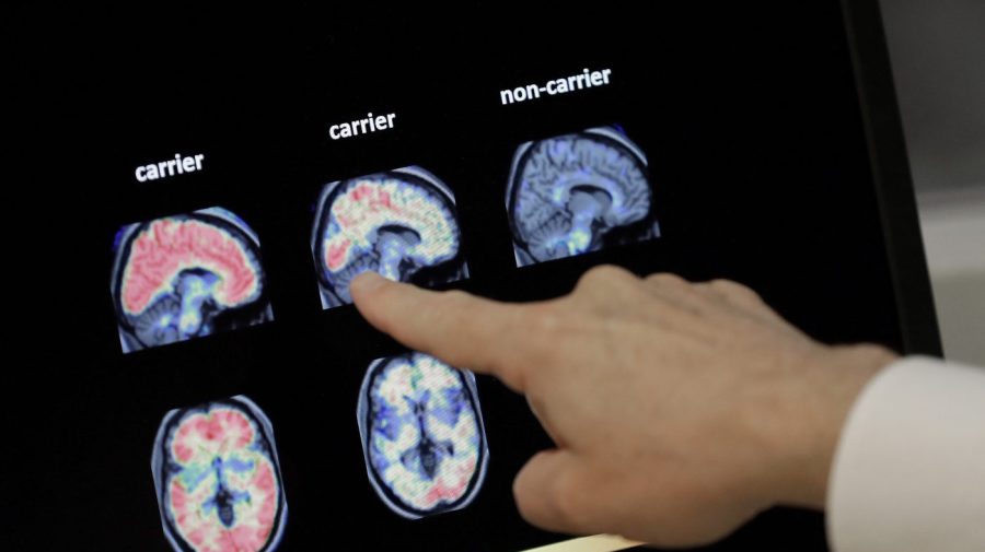 blood-test-could-help-identify-people-at-high-risk-for-alzheimer’s-disease,-study-shows