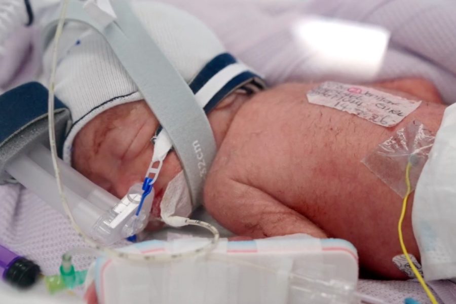 woman-gives-birth-to-rare-identical-quadruplet-girls-in-australia