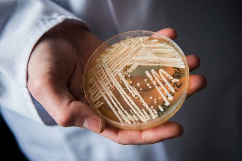 superbug-confirmed-in-23-states:-where-is-the-deadly-fungus-spreading-in-2026?