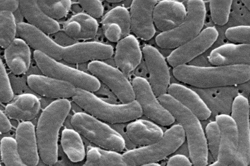 ‘flesh-eating’-bacteria-death-reported-in-florida