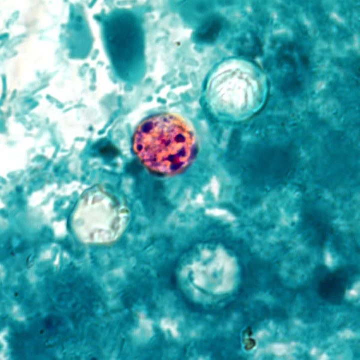 yet-another-cyclosporiasis-outbreak-appears-as-cases-linked-to-recalled-lettuce-grow