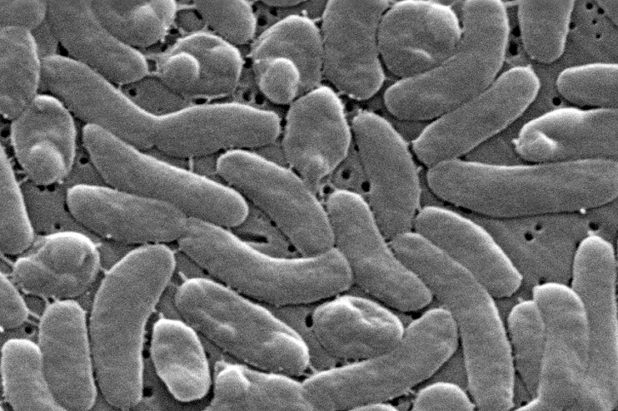 death-toll-from-flesh-eating-bacteria-rises:-these-are-the-vibrio-warning-signs-to-watch-for
