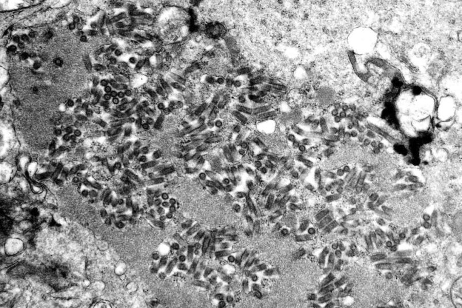 human-rabies-exposure-cases-on-the-rise,-cdc-warns
