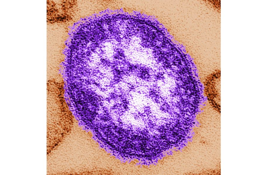 pennsylvania-woman-dies-from-measles-complications-amid-growing-outbreak
