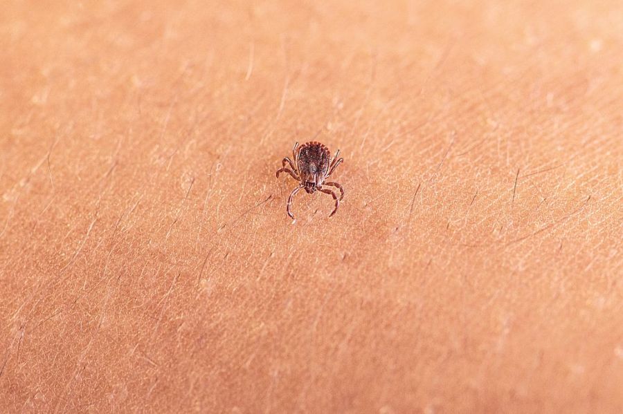 new-virus-detected-in-a-tick-invasive-to-the-us.-should-we-be-concerned?