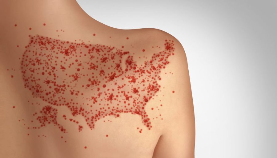 pennsylvania-reports-fourth-measles-death