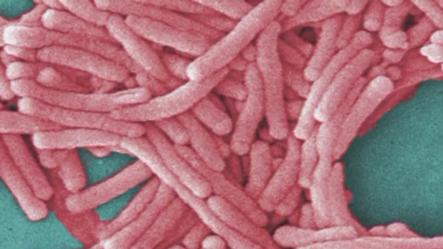 second-death-confirmed-in-bronx-legionnaires’-disease-cluster