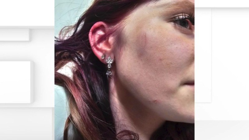 5-students-charged-with-assault-after-fight-at-ohio-school-dance