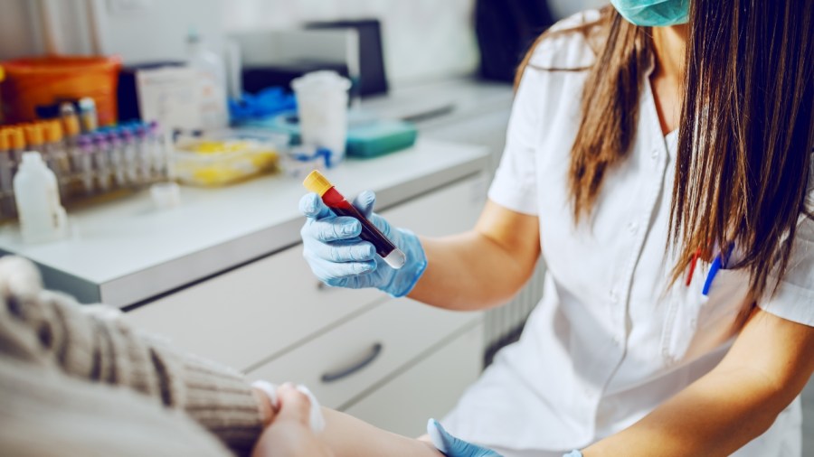 doctors-say-you-should-have-this-cholesterol-level-checked
