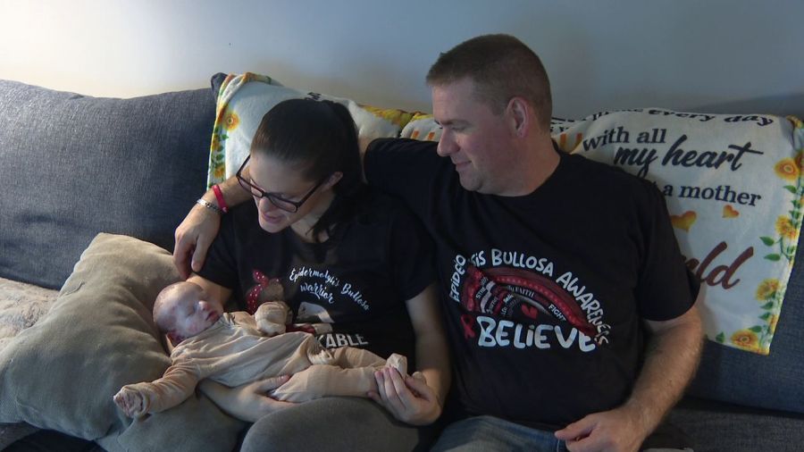 boardman-newborn-faces-unprecedented-dual-diagnosis